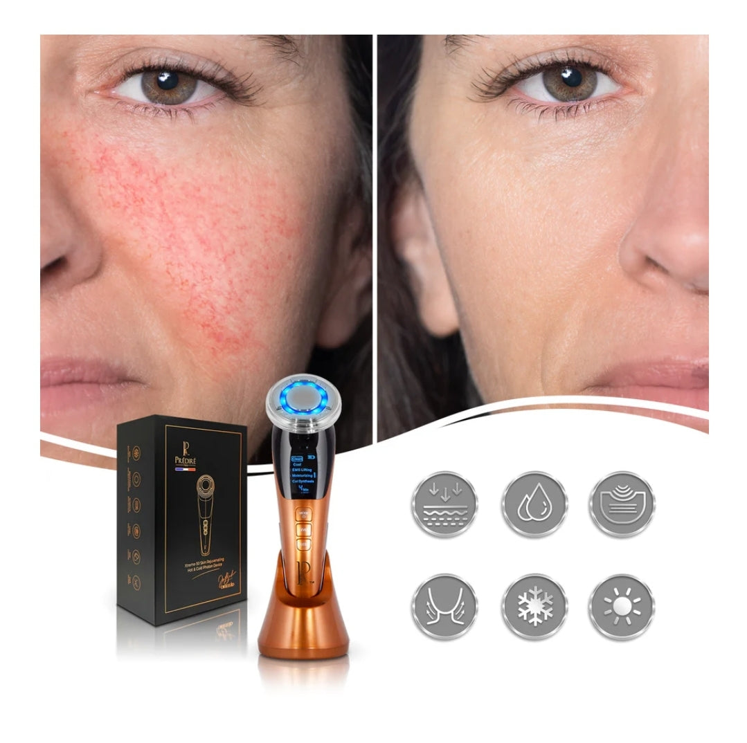 Xtreme-50 Skin Rejuvenating Hot & Cold Photon Device
